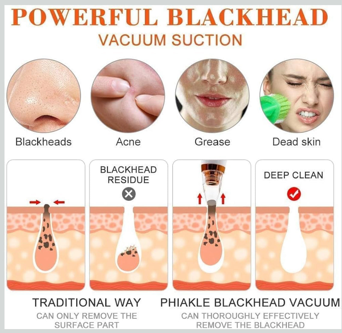 Remove Blackhead Device